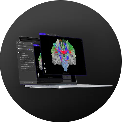 Neuroplasticity computer software on a laptop | Florida BrainLink Initiative