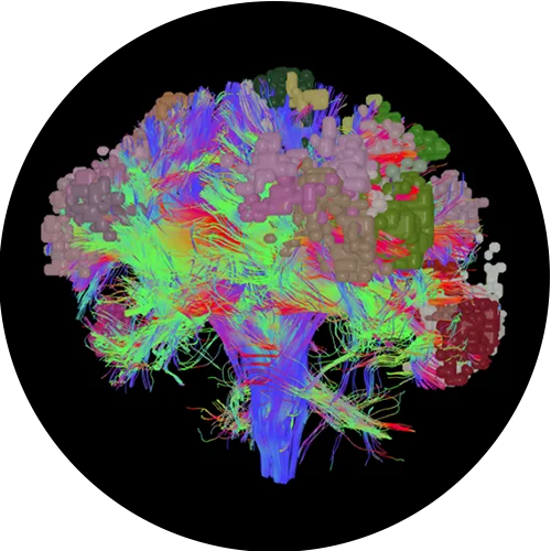 Visual brain scan model | Connectomics & TMS | Florida BrainLink Initiative